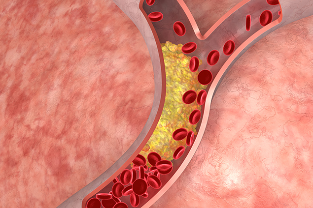 Cholesterol Unmasked – The Vital Life Force Turned Villain by Modern Lifestyles